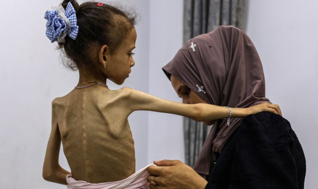 El hambre como arma del Estado racista de Israel en el Holocausto palestino